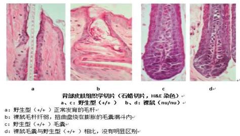 為什麼會長毛|乳頭邊長了毛，是什麼病？該不該拔？讓名醫一次解釋給您聽｜每